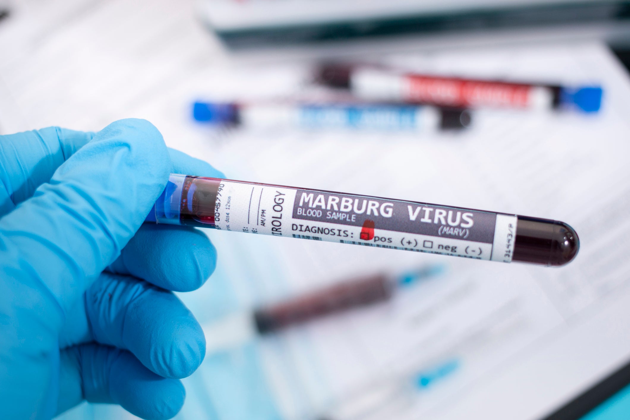 A Marburg virus outbreak was declared in Rwanda on 27 September