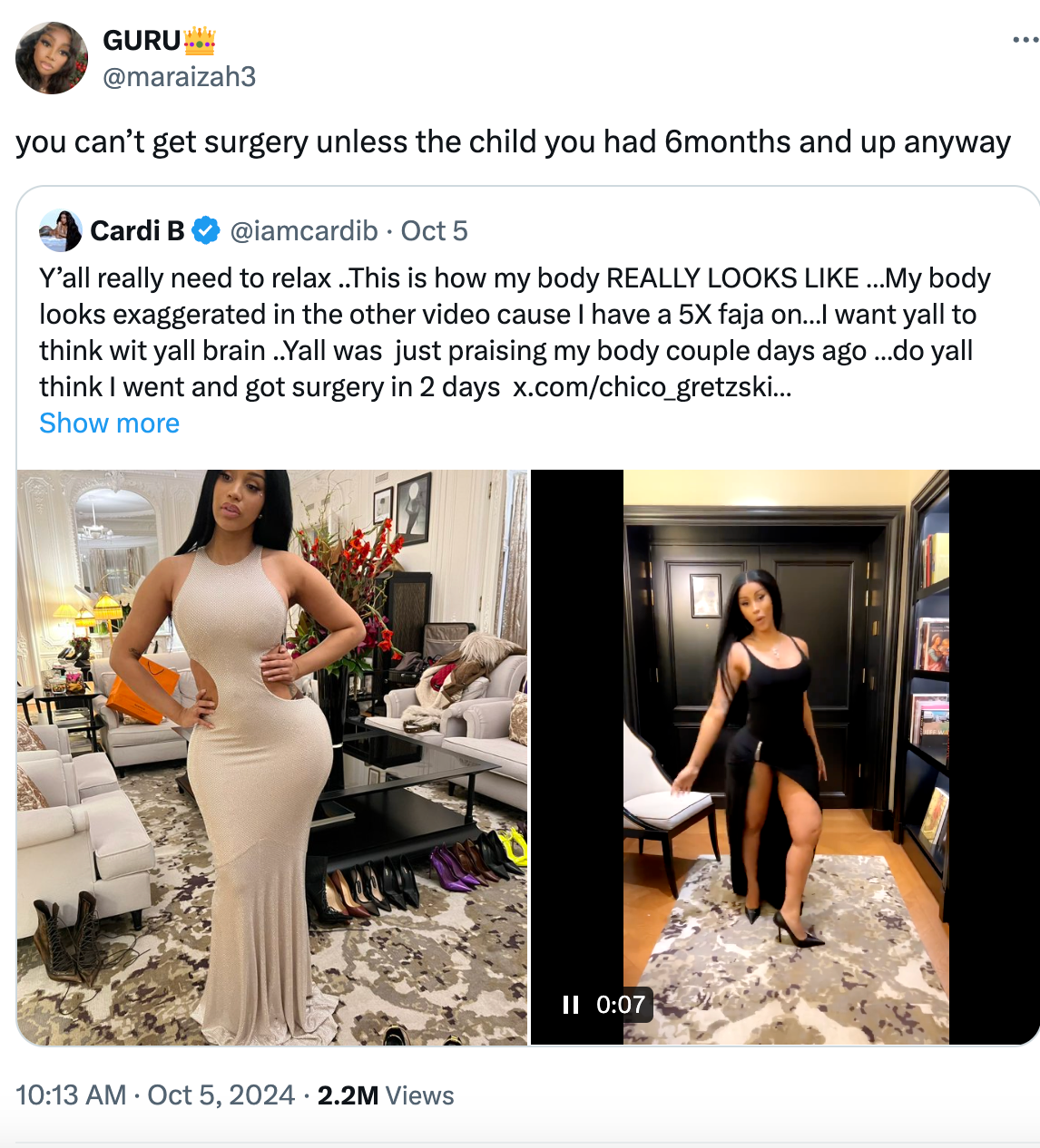 Fan defends Cardi B against plastic surgery accusations