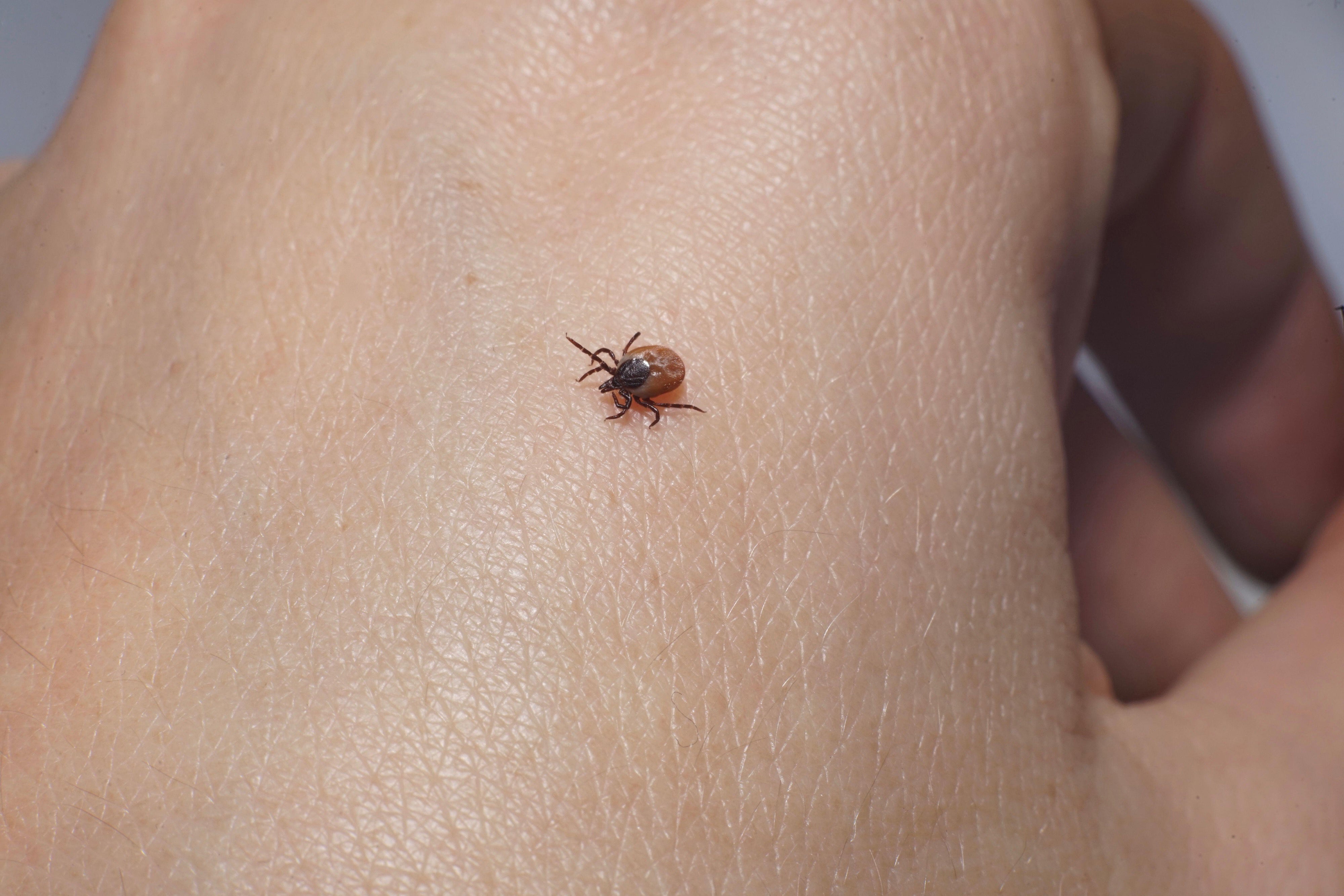 Lyme disease is caused by bites from infected ticks.