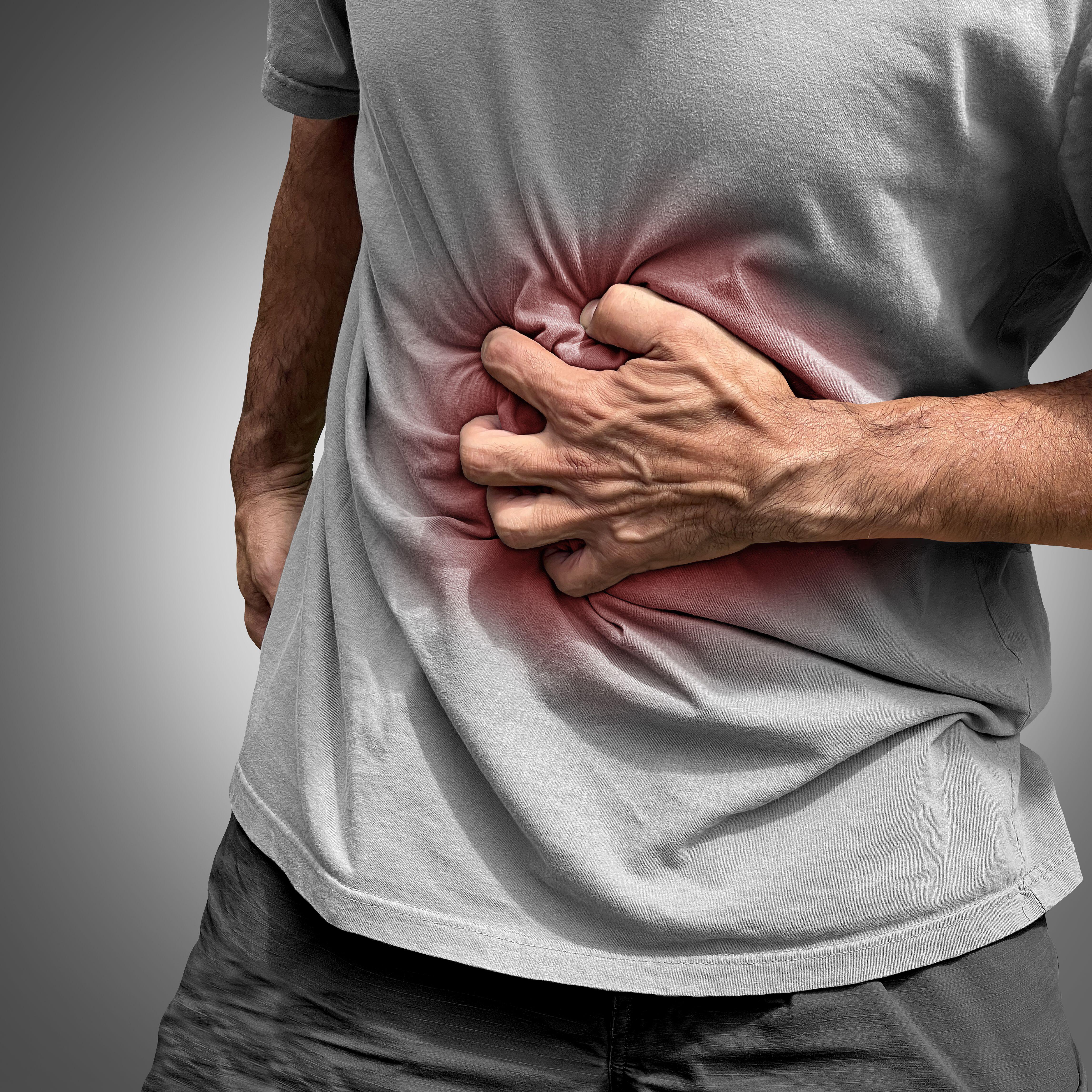 Gut inflammation (Alamy/PA)