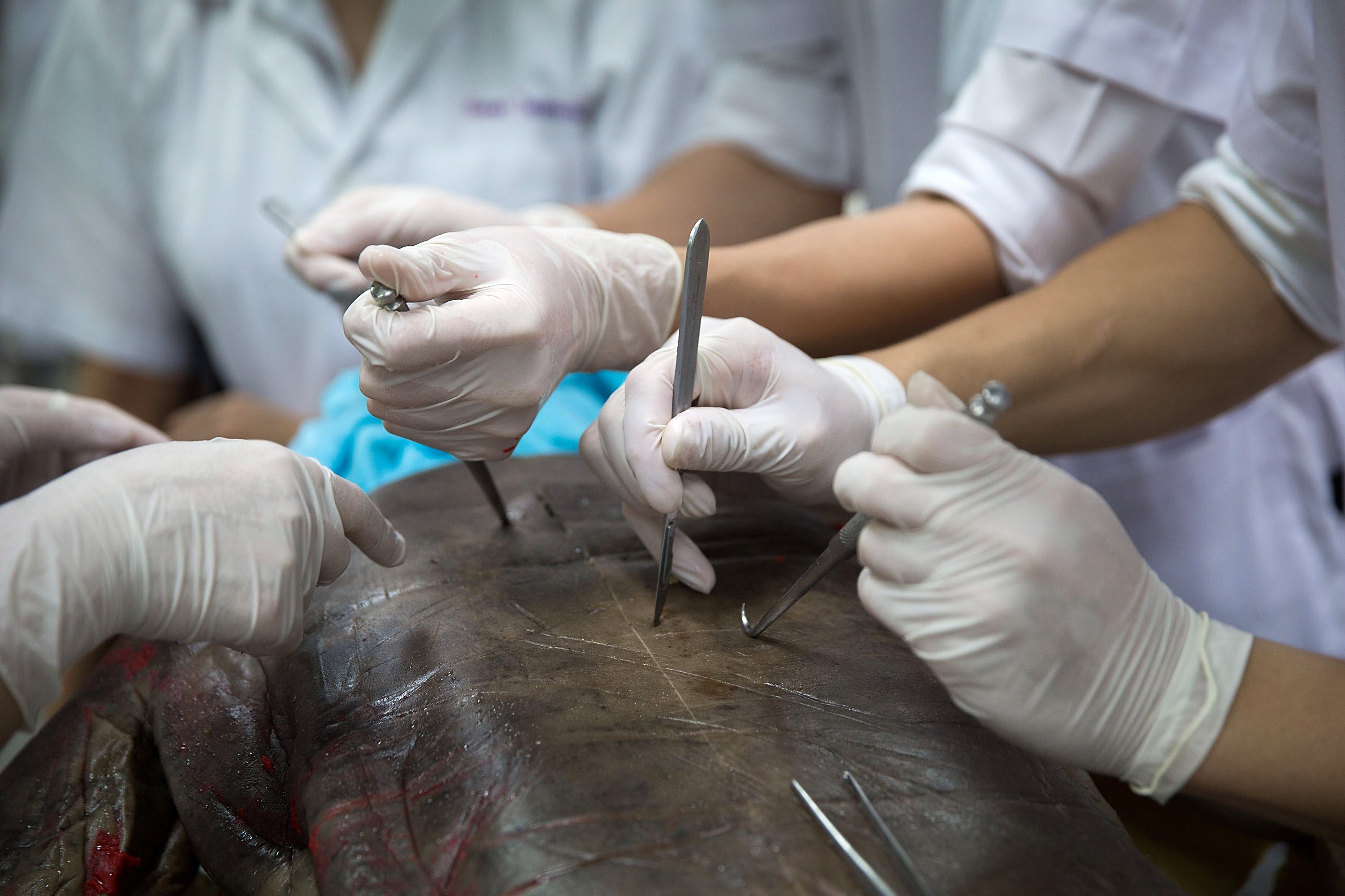 Medical students dissect a cadaver – stock image