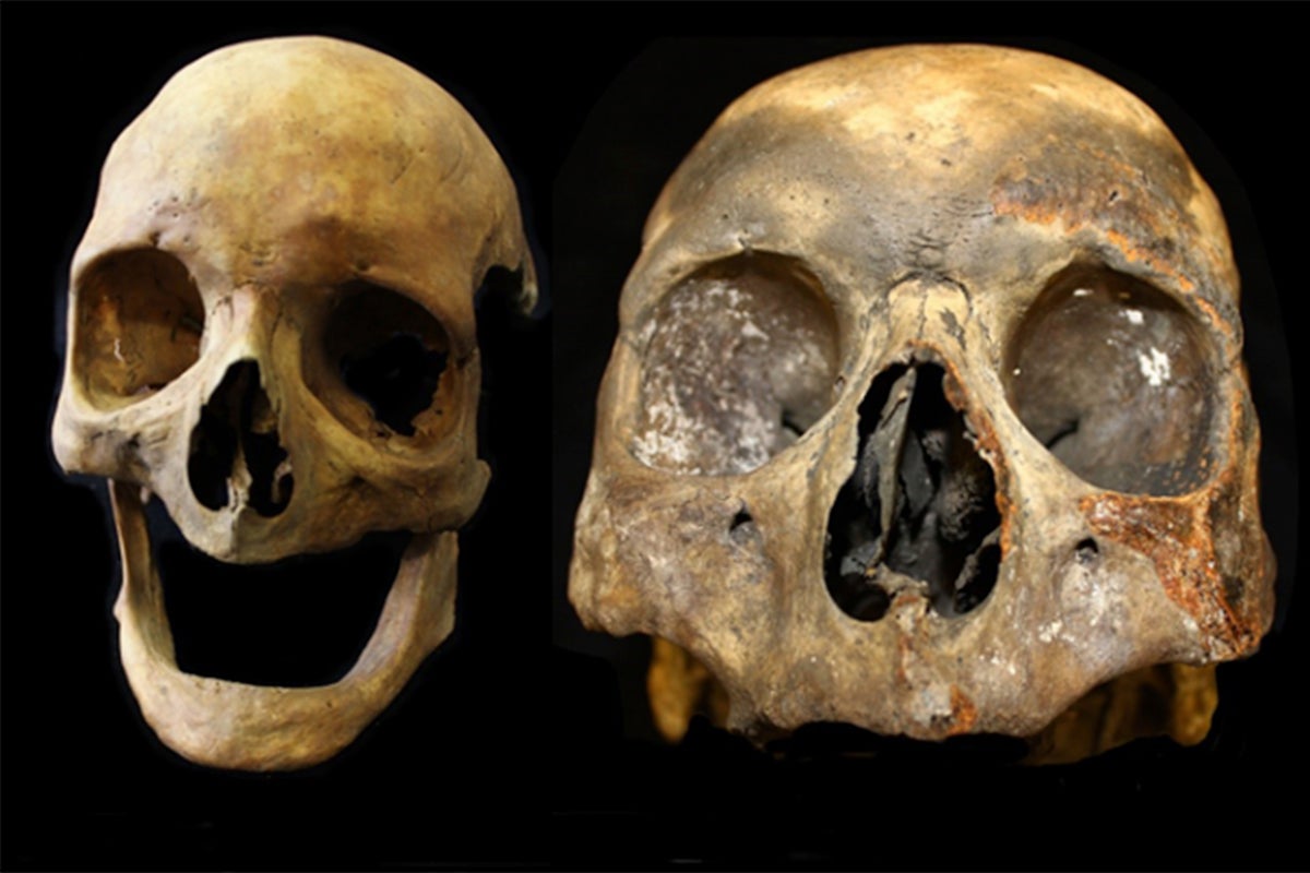 Significant' permanent side-effect of smoking discovered by archaeologists 