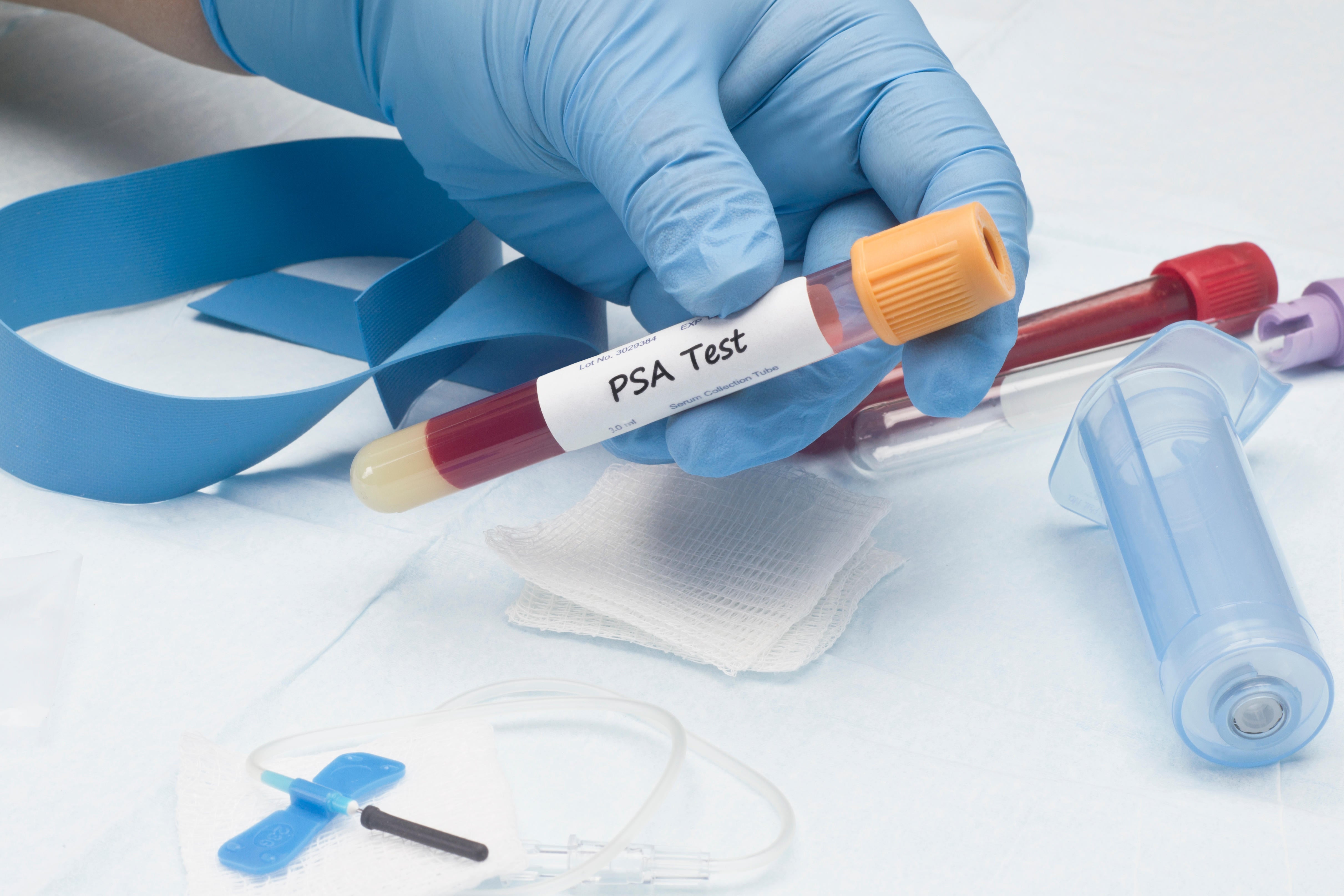 Psa Uk How men can get checked for prostate cancer | The Independent