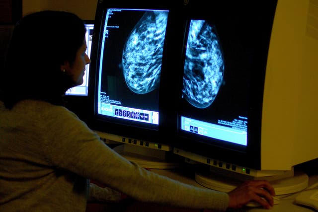 More than 56,000 people in the UK are diagnosed with breast cancer each year (Rui Vieira/PA)