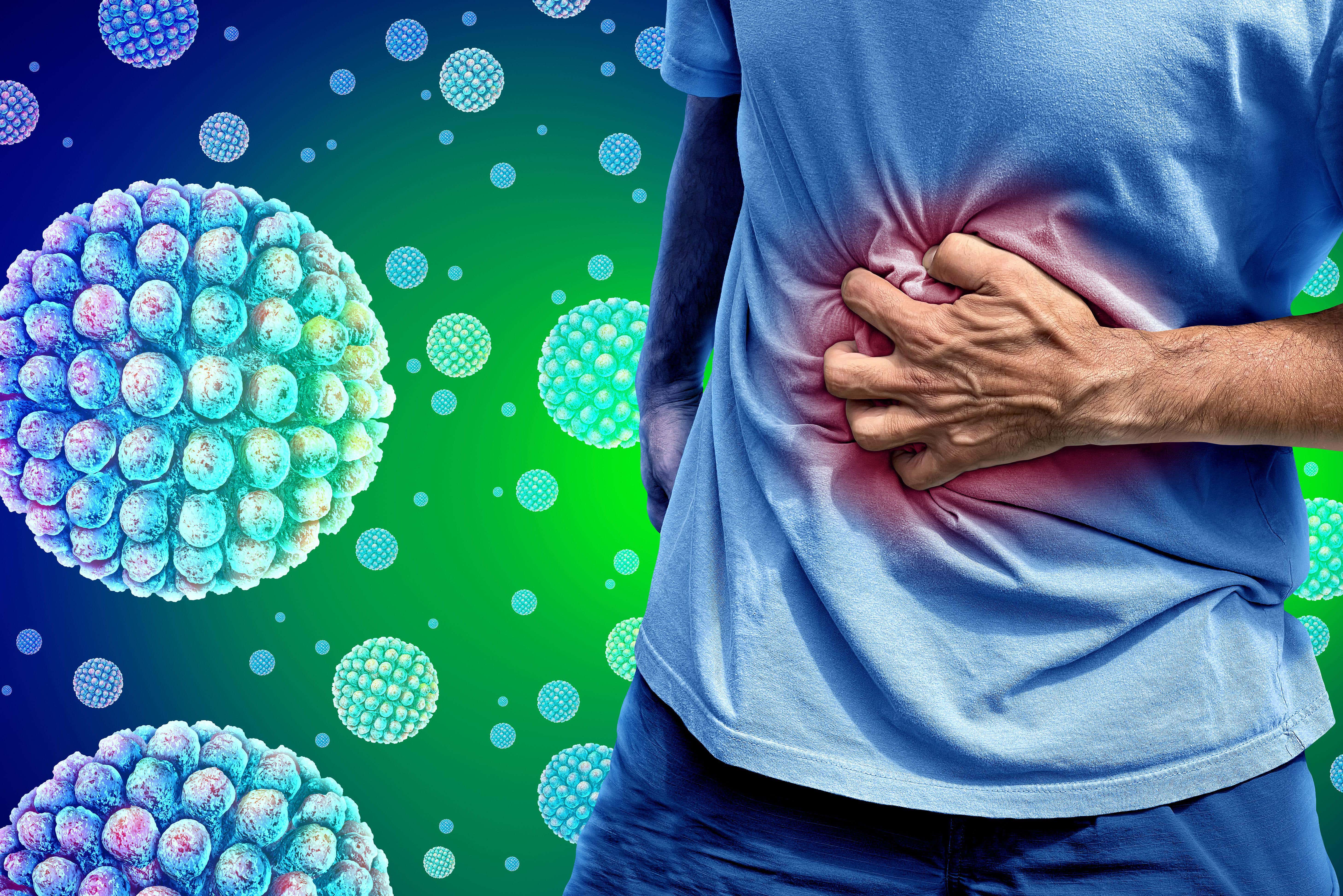 One of the main symptoms of norovirus is stomach cramps (Alamy/PA)