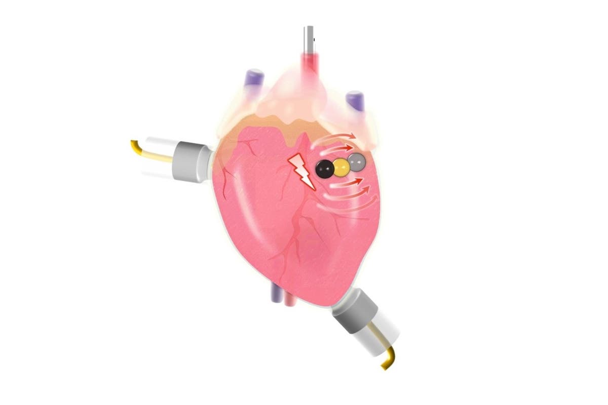 Scientists invent biodegradable battery that controls the beating of hearts