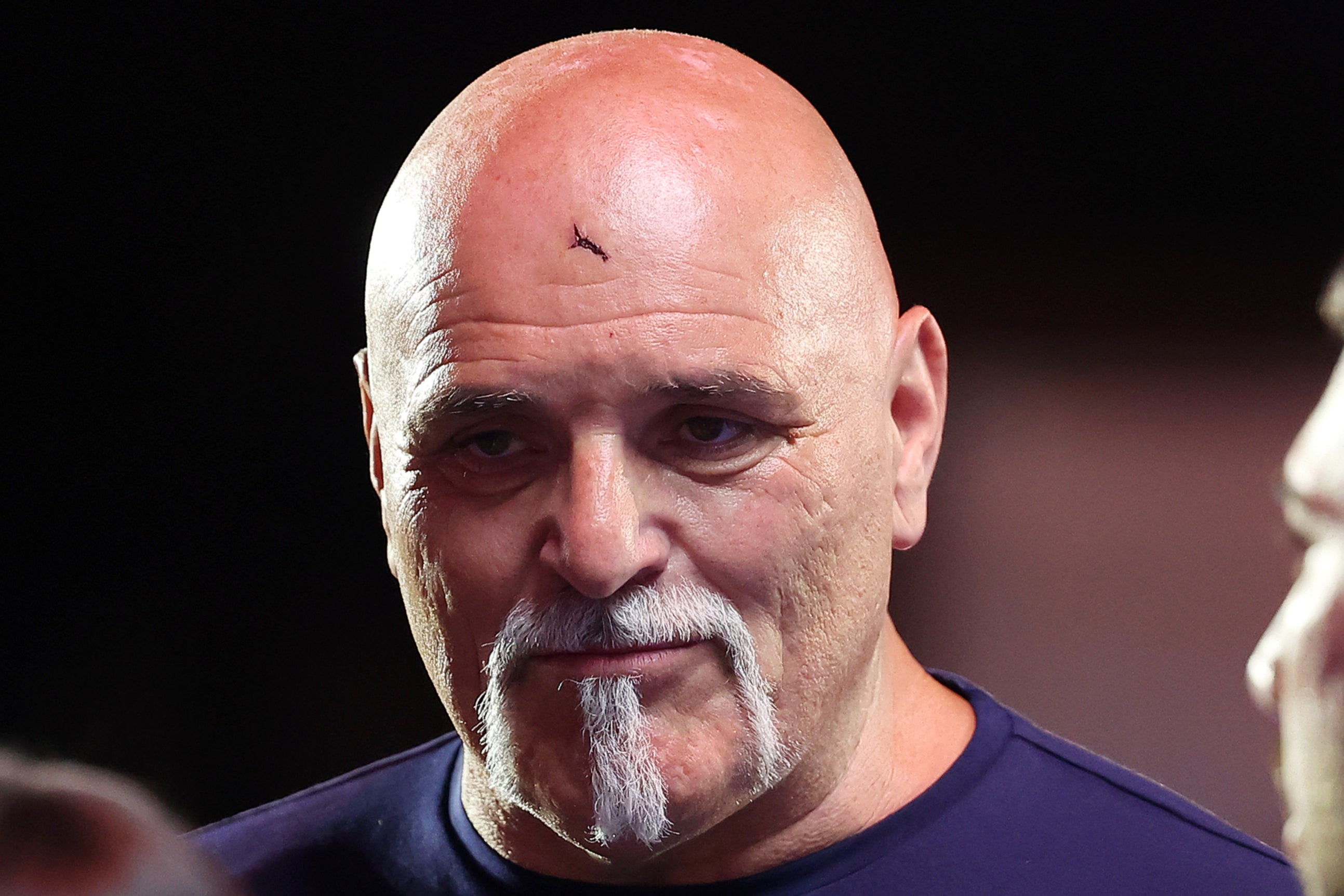 John Fury sustained a cut by headbutting one of Oleksandr Usyk’s teammates in May