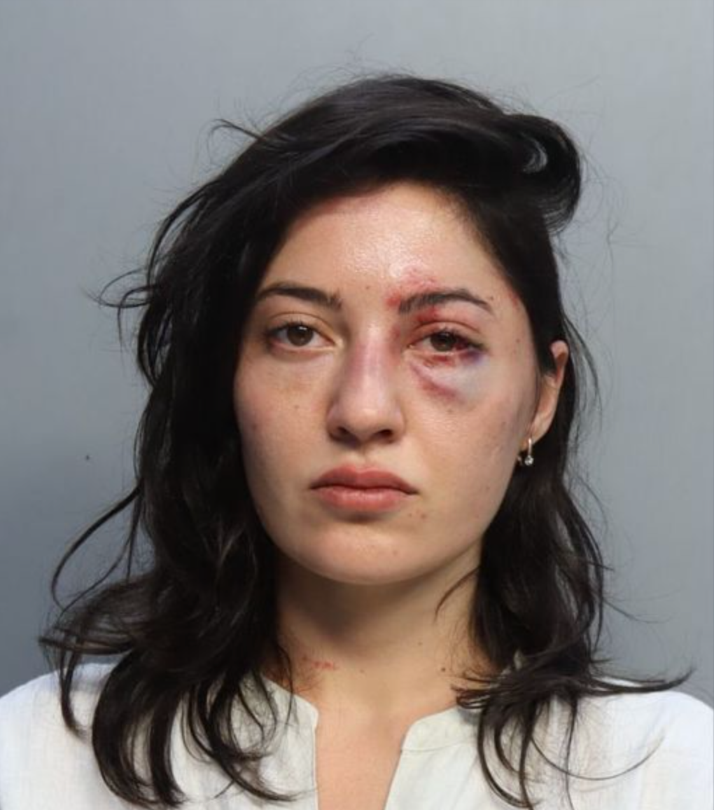 Sabina Rosas was arrested last year in Miami and charged with battery, but the precise circumstances are unknown