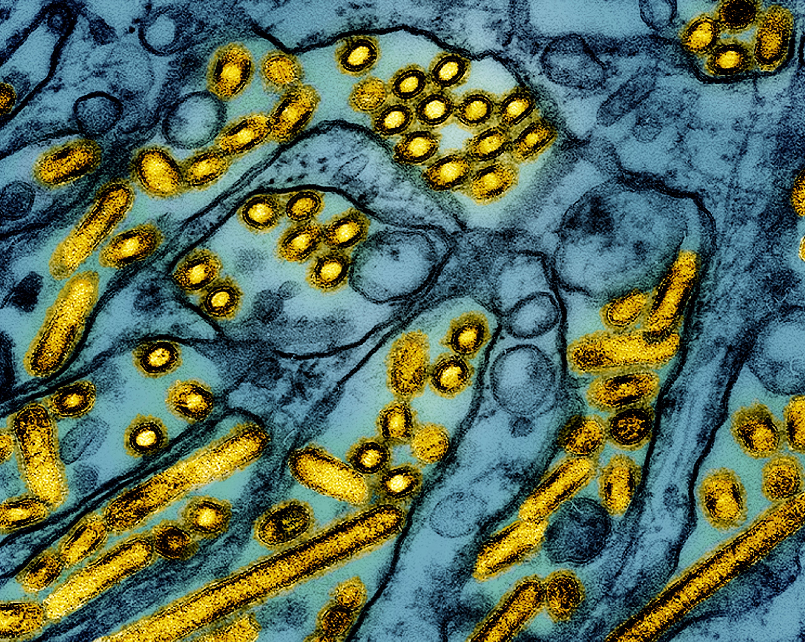 A colorized electron microscope image shows H5N1 virus particles. The increase in cases has some people remembering th 2009 H1N1 outbreak