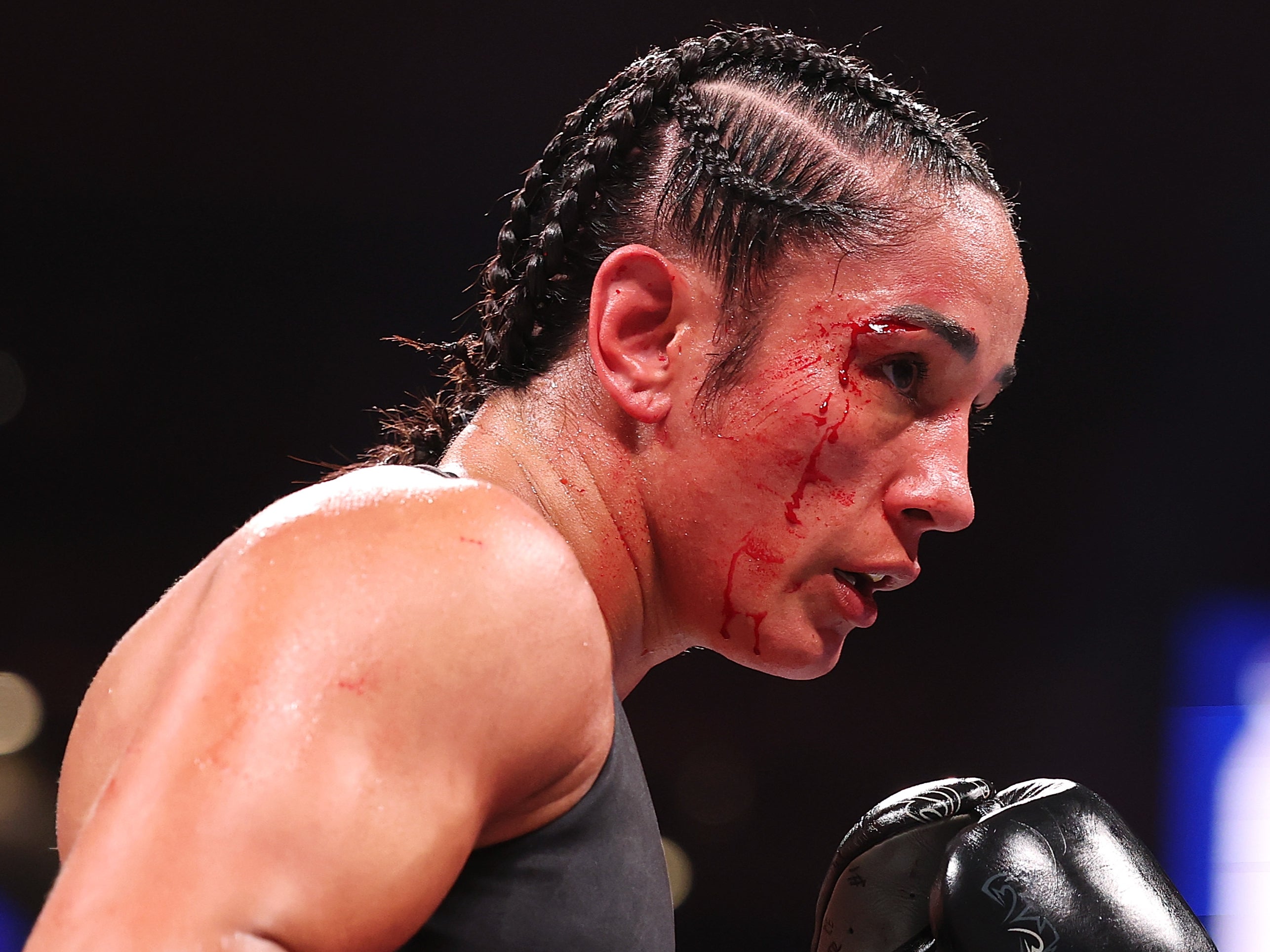 The legendary Amanda Serrano is the biggest name on MVP’s impressive female roster