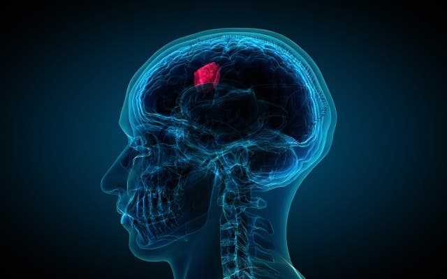 <p>While brain tumors aren’t all cancerous, they can still be dangerous to those who have them. New research is using AI to better detect tumors in MRI images</p>