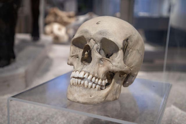 An MP has told the Commons she had heard cases of body parts being sold online and in auction houses (Alamy/PA)