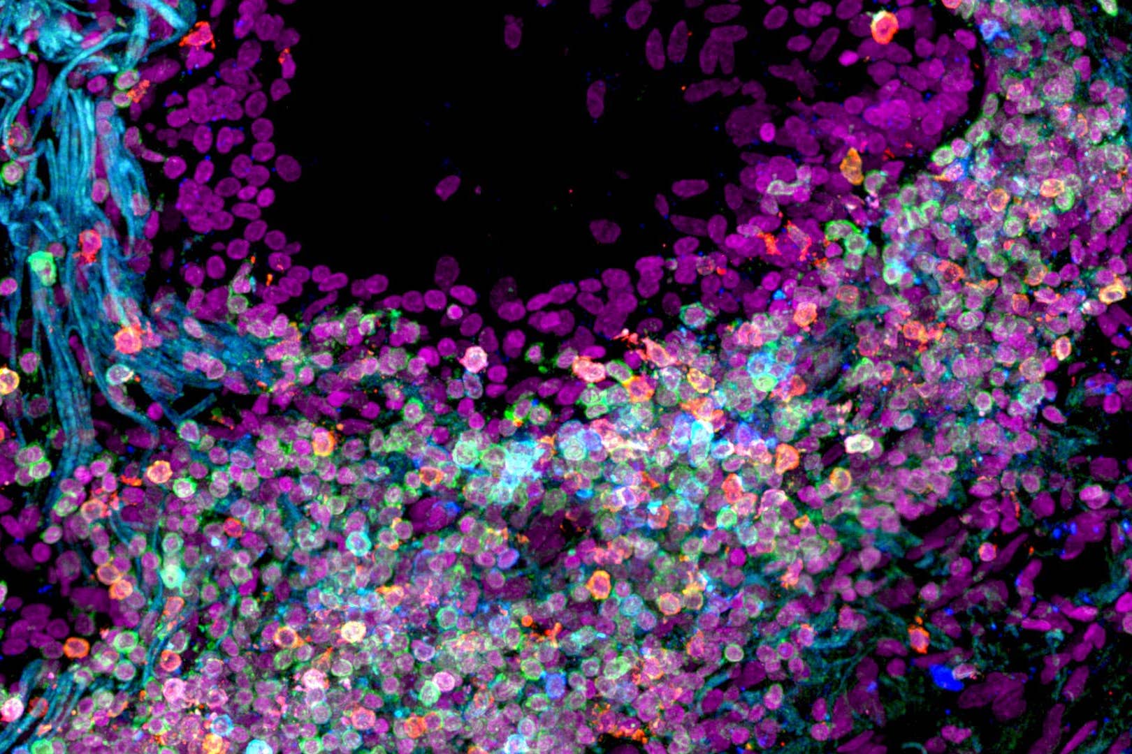 Human lung tissue represented in waves of purple, pink and blue circles (Nathan Richoz/University of Cambridge