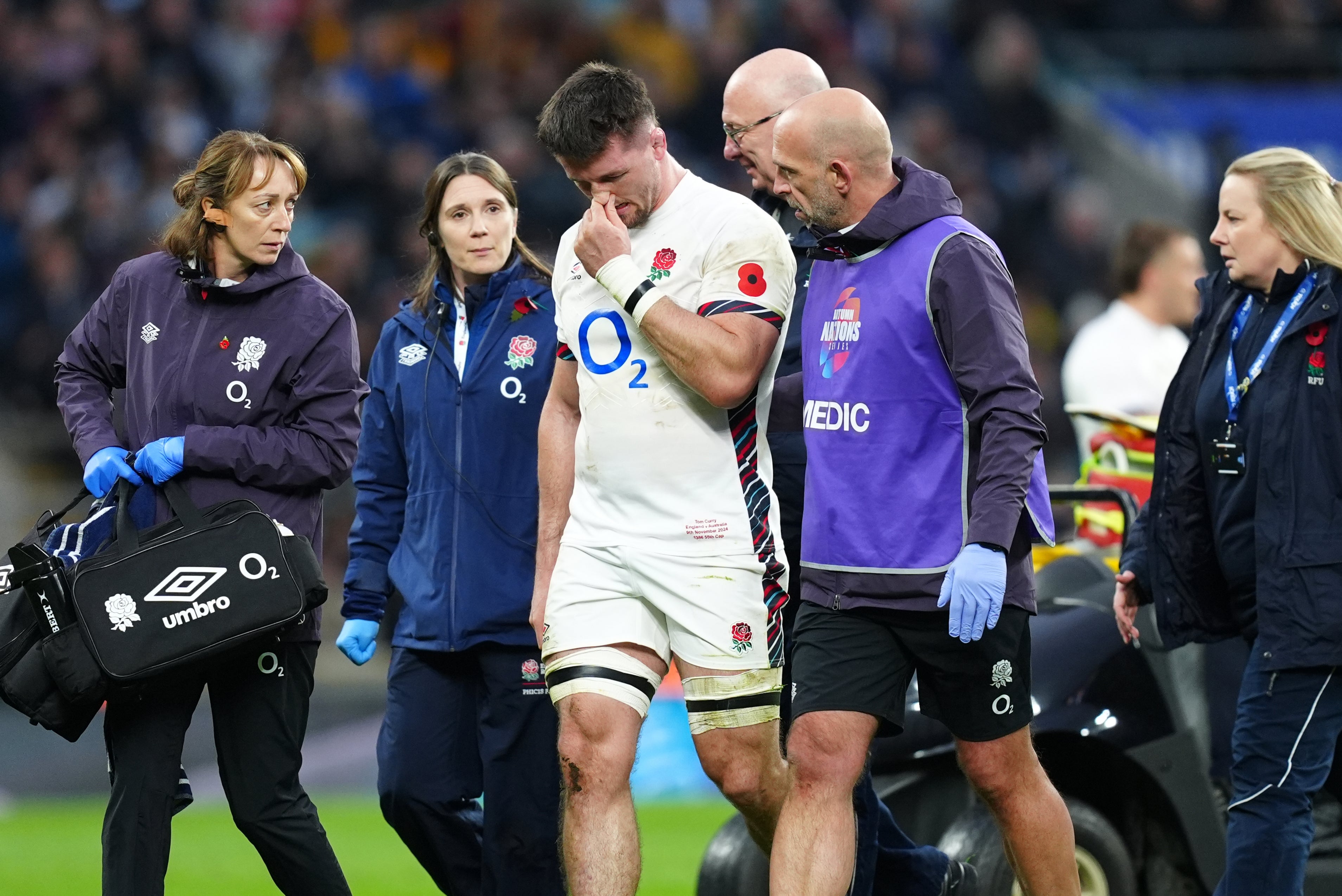 Tom Curry was helped off the pitch after his latest concussion against Australia