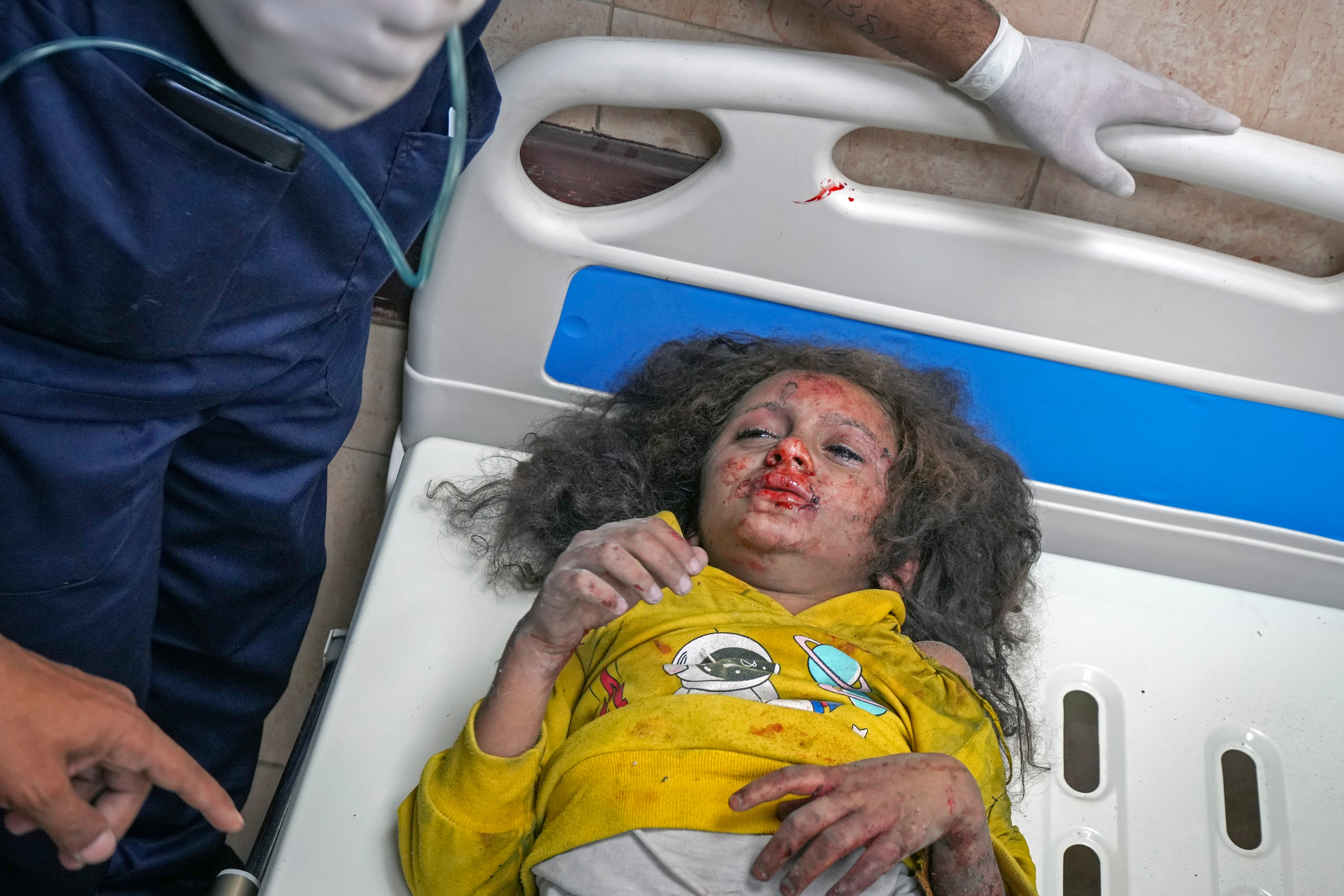 A child in Gaza injured in an Israeli strike