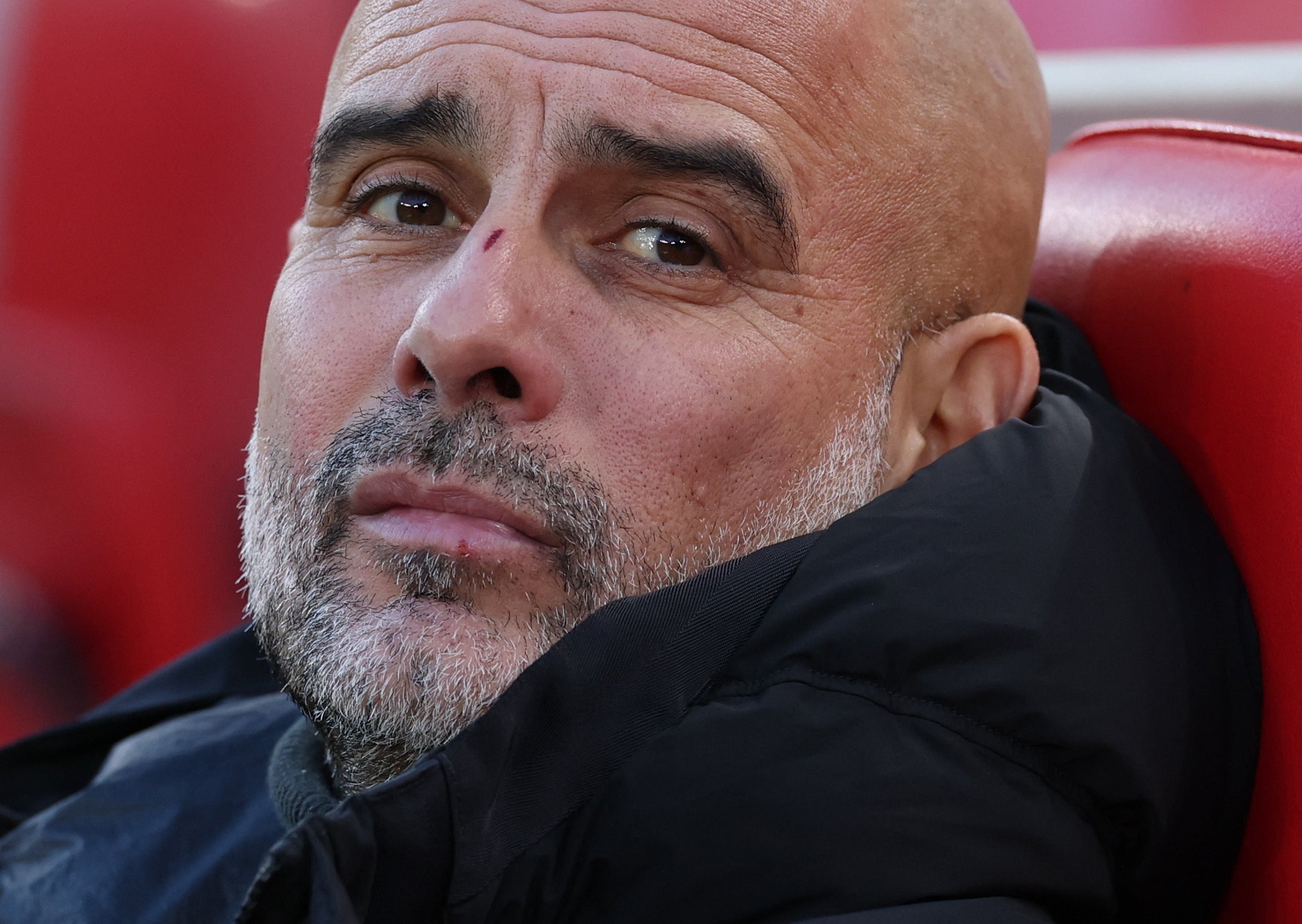 Guardiola emerged in midweek with scratches on his face