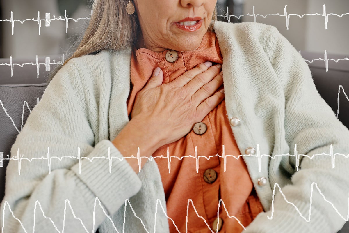 Blood thinner could be more effective than common drug at preventing heart attacks