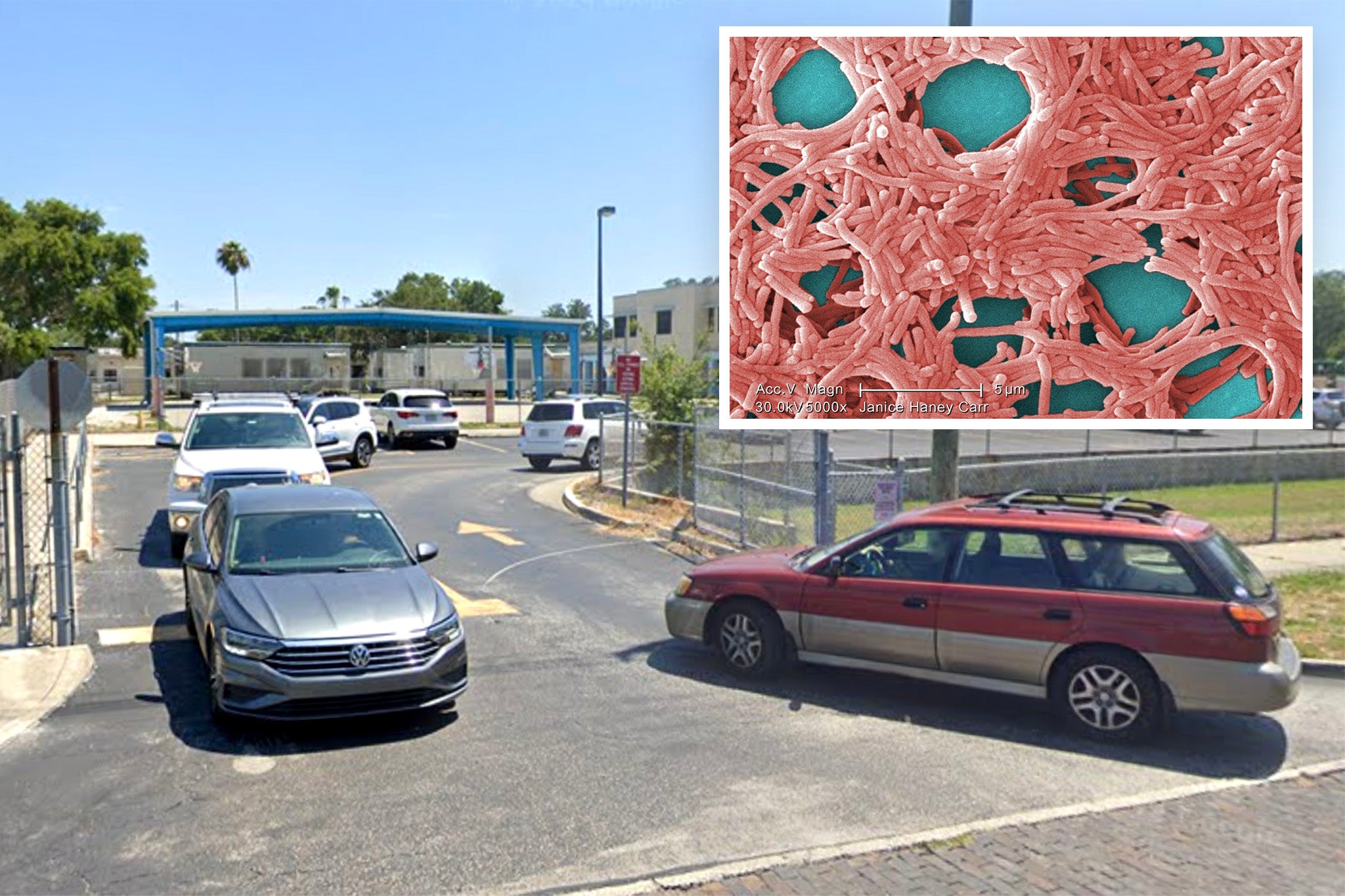 Katherine Pennington, 61, a Florida teacher was reportedly admitted to hospital with a high fever, chills, a painful headache and sweats – which rapidly deteriorated until her organs started to fail