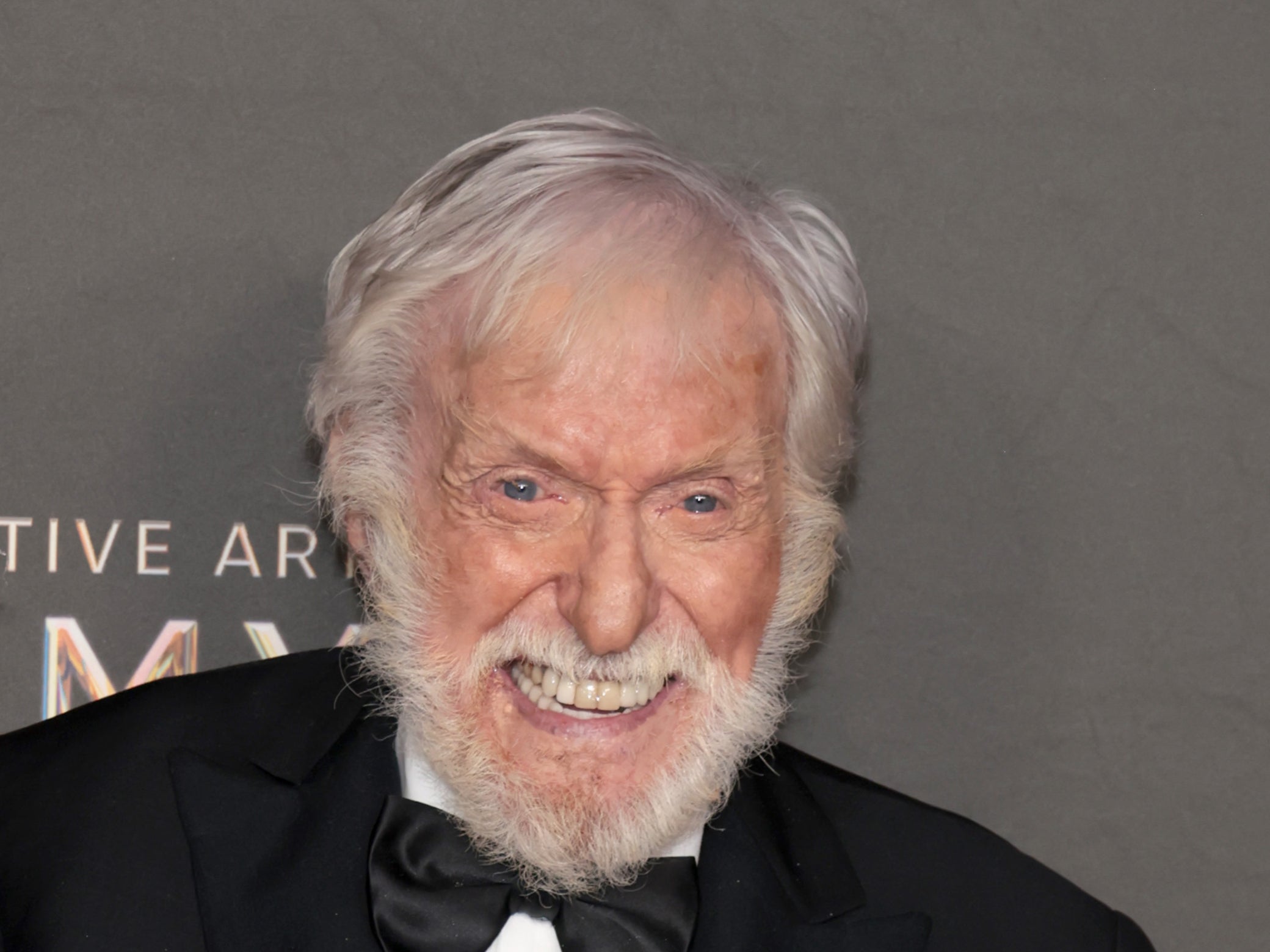 Dick Van Dyke shared his concern for his missing cat, Bobo, who escaped from their home just before he and his wife evacuated to escape the Malibu wildfires