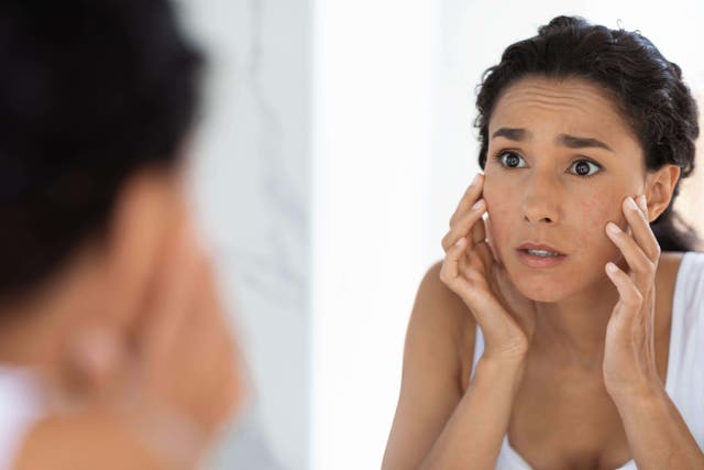 Experts discuss whether you should use beef tallow on your skin (Alamy/PA)