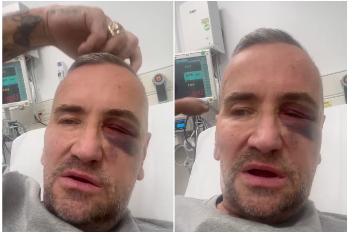 DJ Fat Tony shares shocking video of him being knocked out at gig