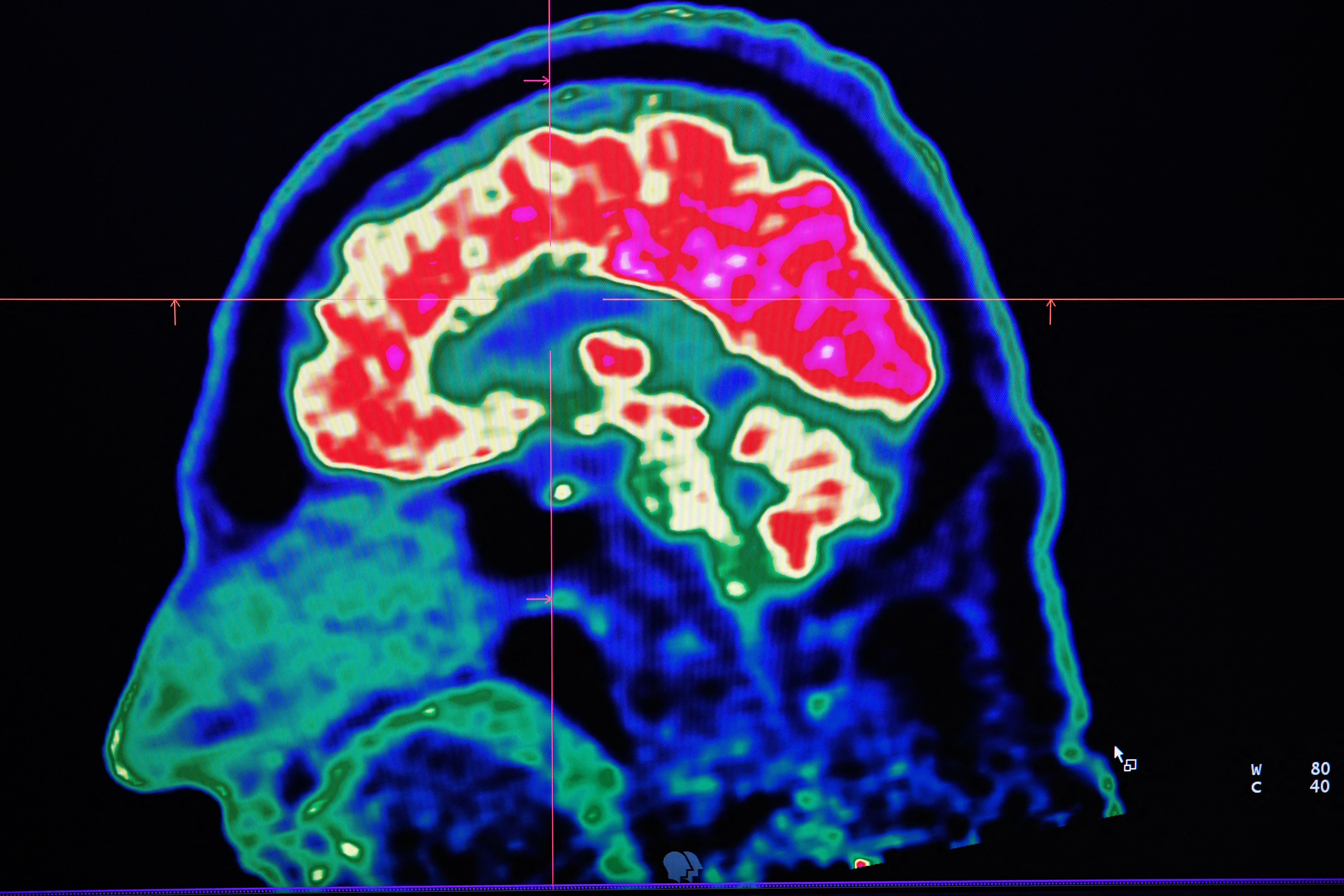 independent.co.uk - Vishwam Sankaran - Scientists measure exact speed of human thought - the results are surprising