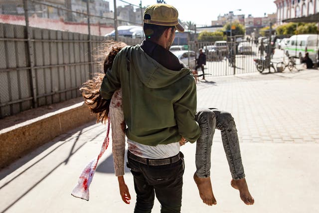 <p>A wounded Palestinian child is carried to Nasser Hospital in Khan Younis</p>