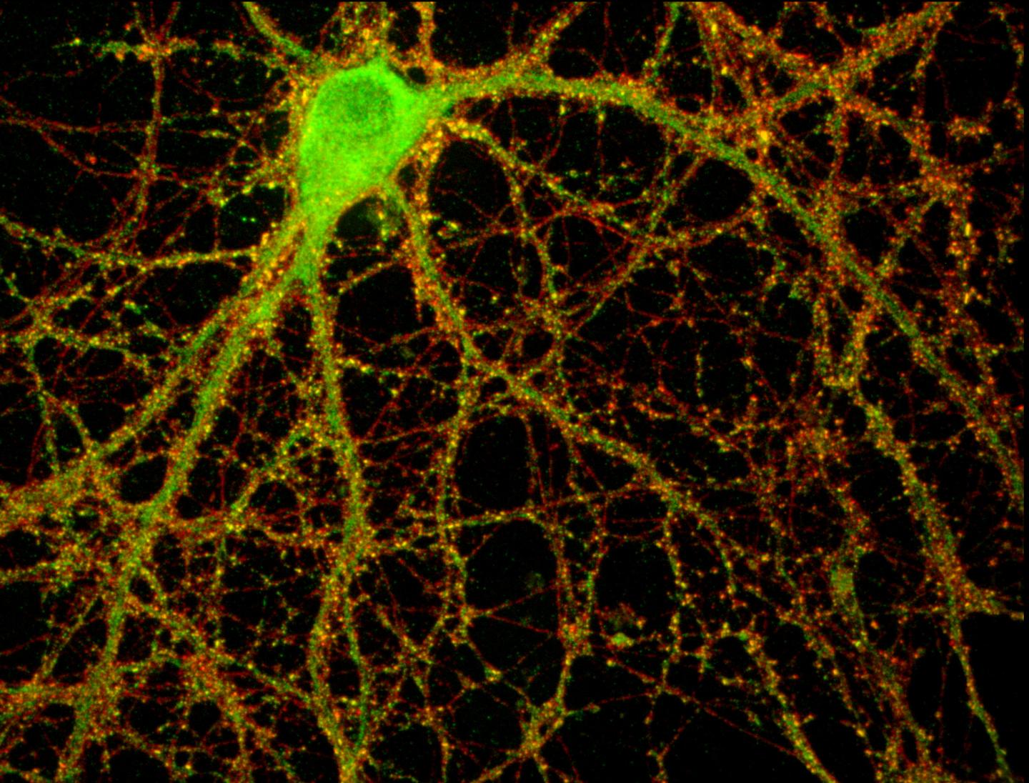 A mouse hippocampal neuron studded with thousands of synaptic connections