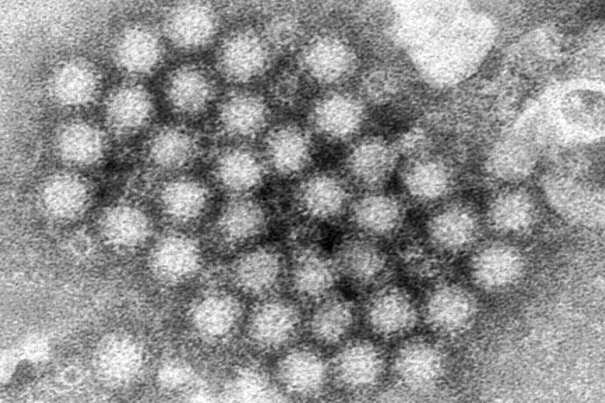 New strain warning as second norovirus wave to hit UK