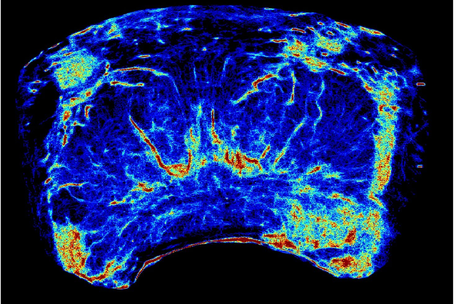 A super-resolution prostate image (Heriot-Watt/PA)