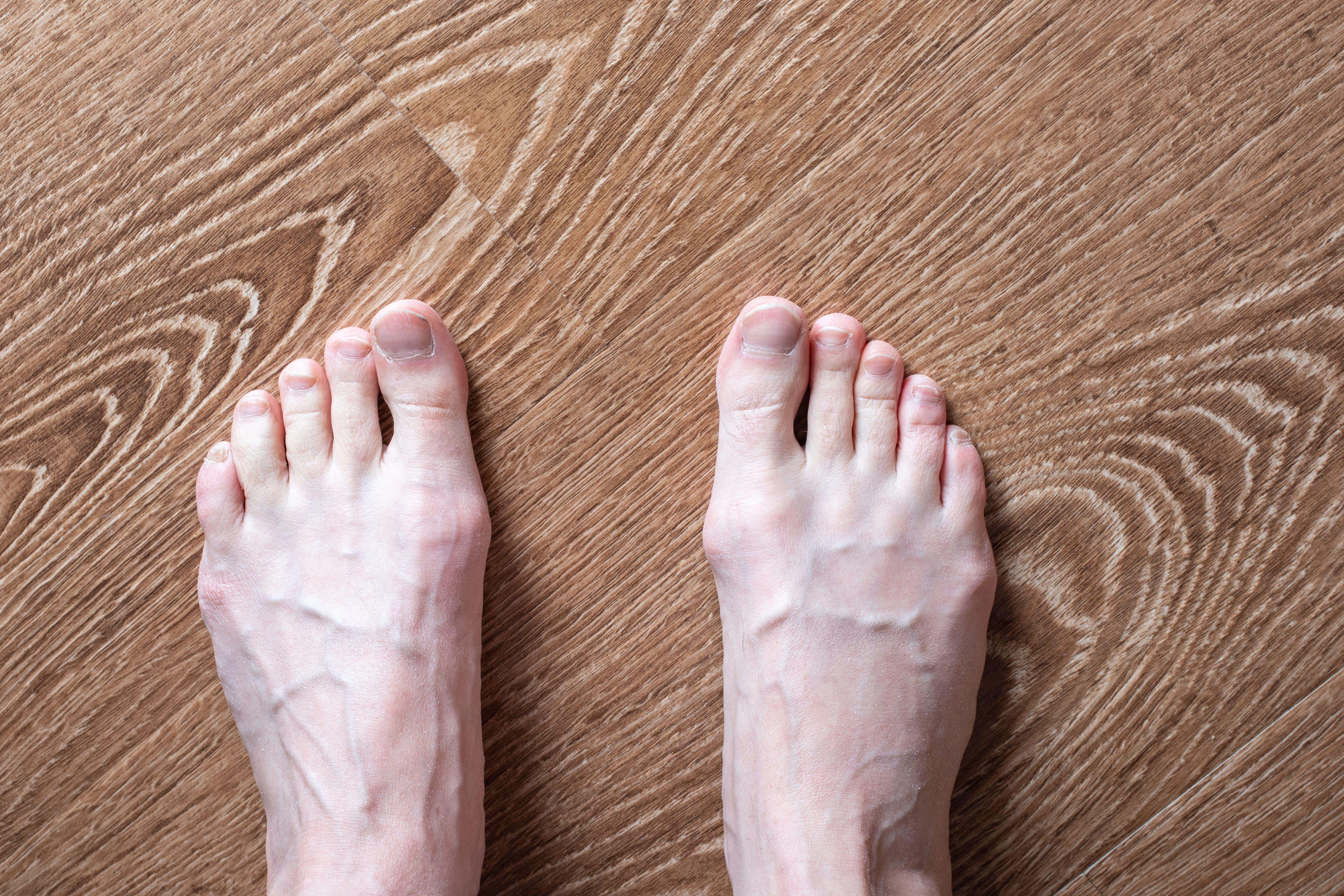 Your feet can often indicate when something is wrong, health-wise (Alamy/PA)