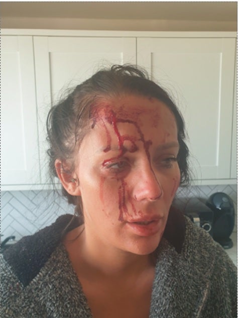 Photos shown to the jury reveal Kiena’s injuries following a final alleged assault by Wellings before she took her own life