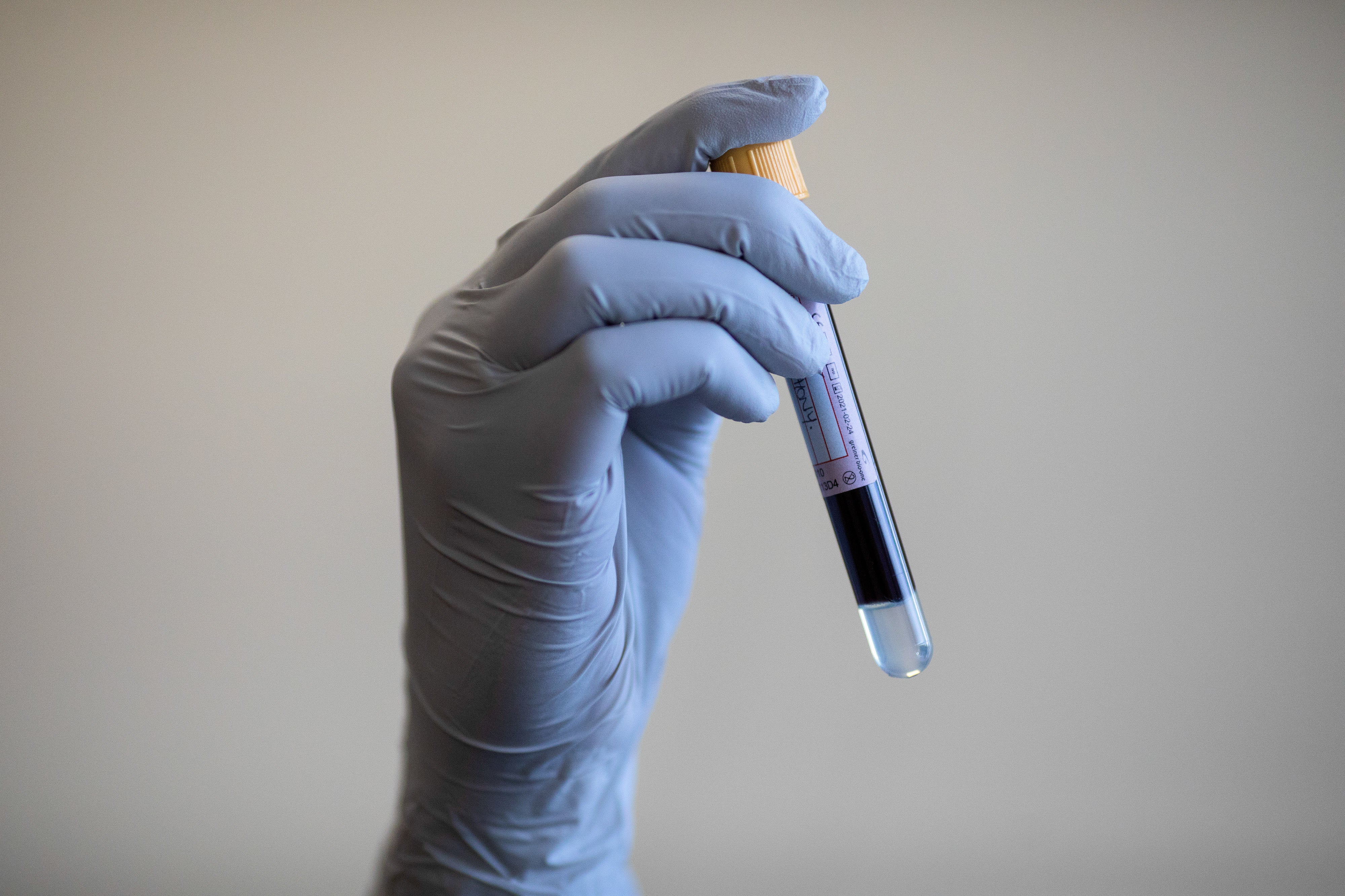 A paramedic holding a test tube containing a blood sample