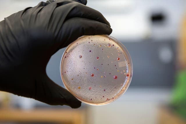 <p>An E.Coli infection can lead to a life-threatening form of kidney failure</p>