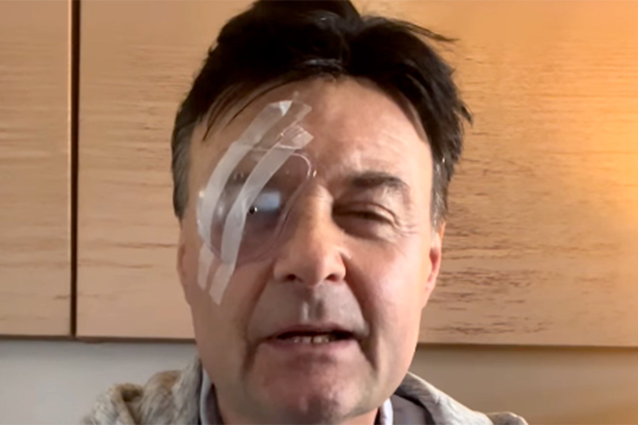 <p>Actor has said he was the victim of an unprovoked violent  attack in December  </p>