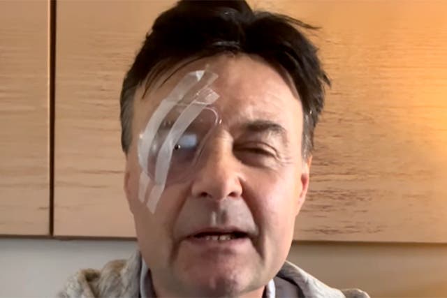 <p>Actor has said he was the victim of an unprovoked violent  attack in December  </p>