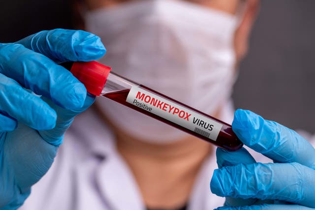 <p>Mpox, formerly known as monkey pox, is very contagious </p>