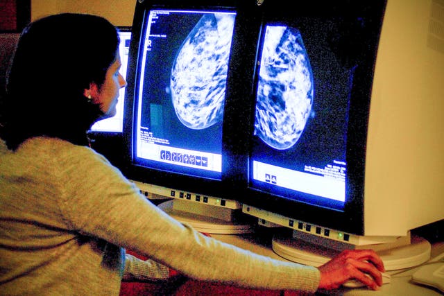 <p>A new trial will use AI to help radiologists in breast cancer screening</p>