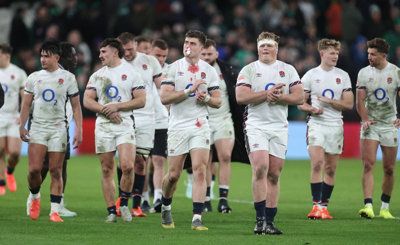 England’s painful progress establishes them as rugby’s Manchester United