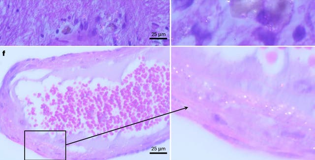 <p>Researchers have found microplastics are making their way into our brains</p>