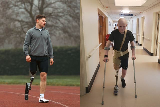 <p>Oliver Liddle, who had his leg amputated to stop the spread of bone cancer</p>