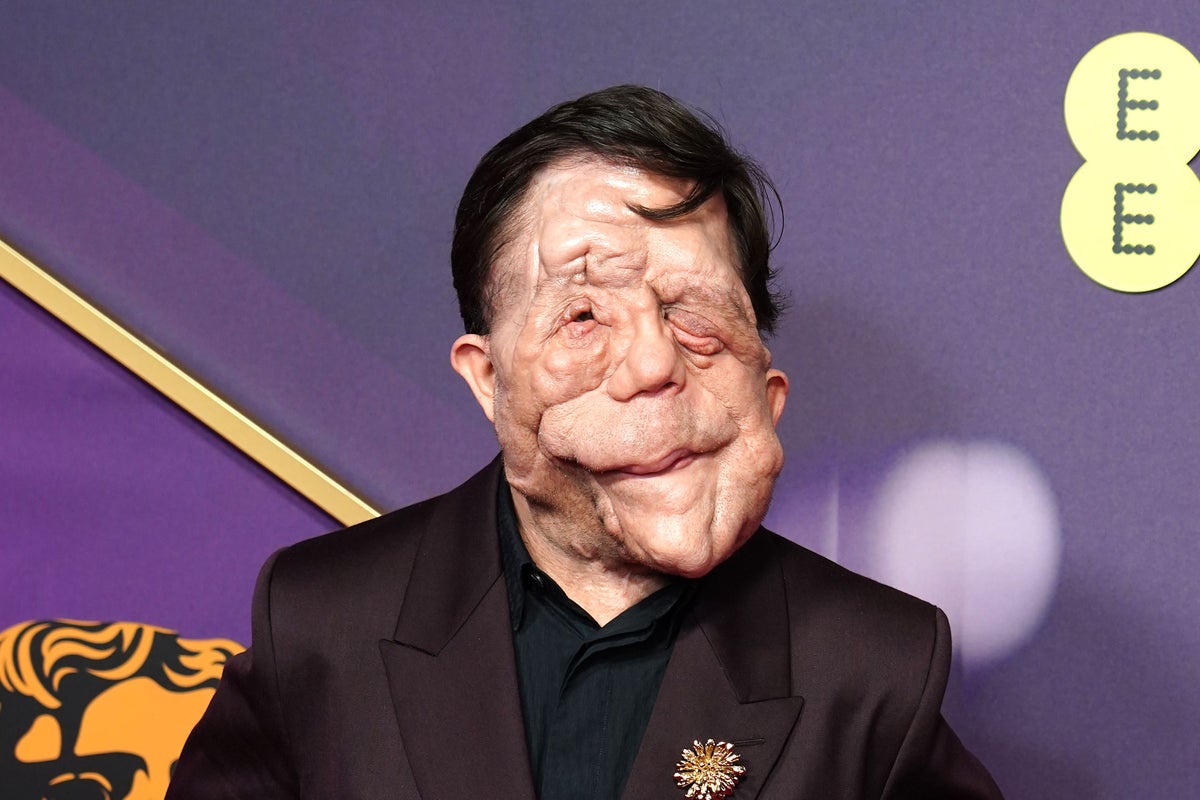Adam Pearson to play Elephant Man in movie remake 