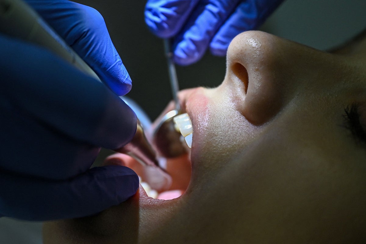 Dentists reveal the truth about ‘Ozempic teeth’