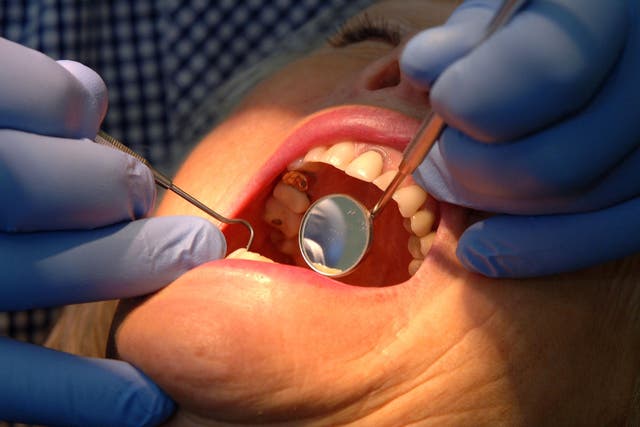 A dentist checking condition of a patient’s teeth (John Giles/PA)