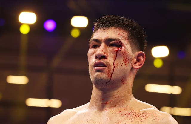 <p>Dmitry Bivol won a majority decision to dethrone Artur Beterbiev in their rematch</p>