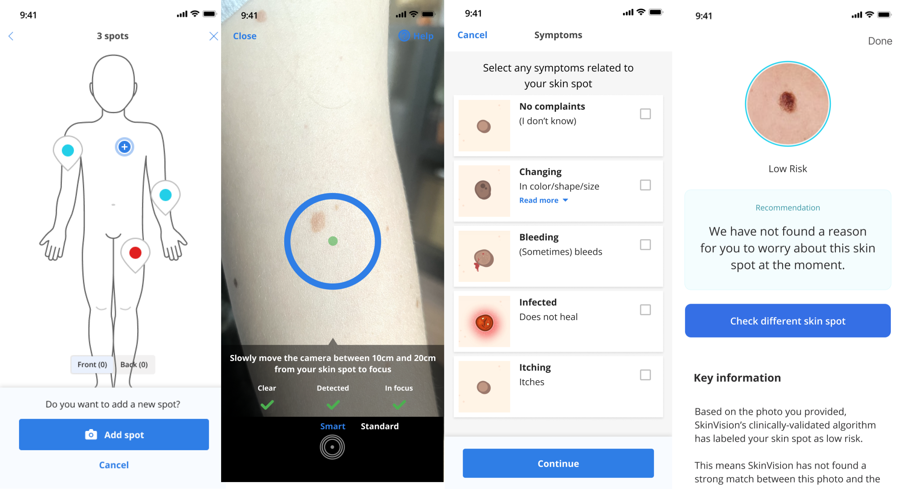 More accurate than your GP: SkinVision’s app gets better results than most doctors