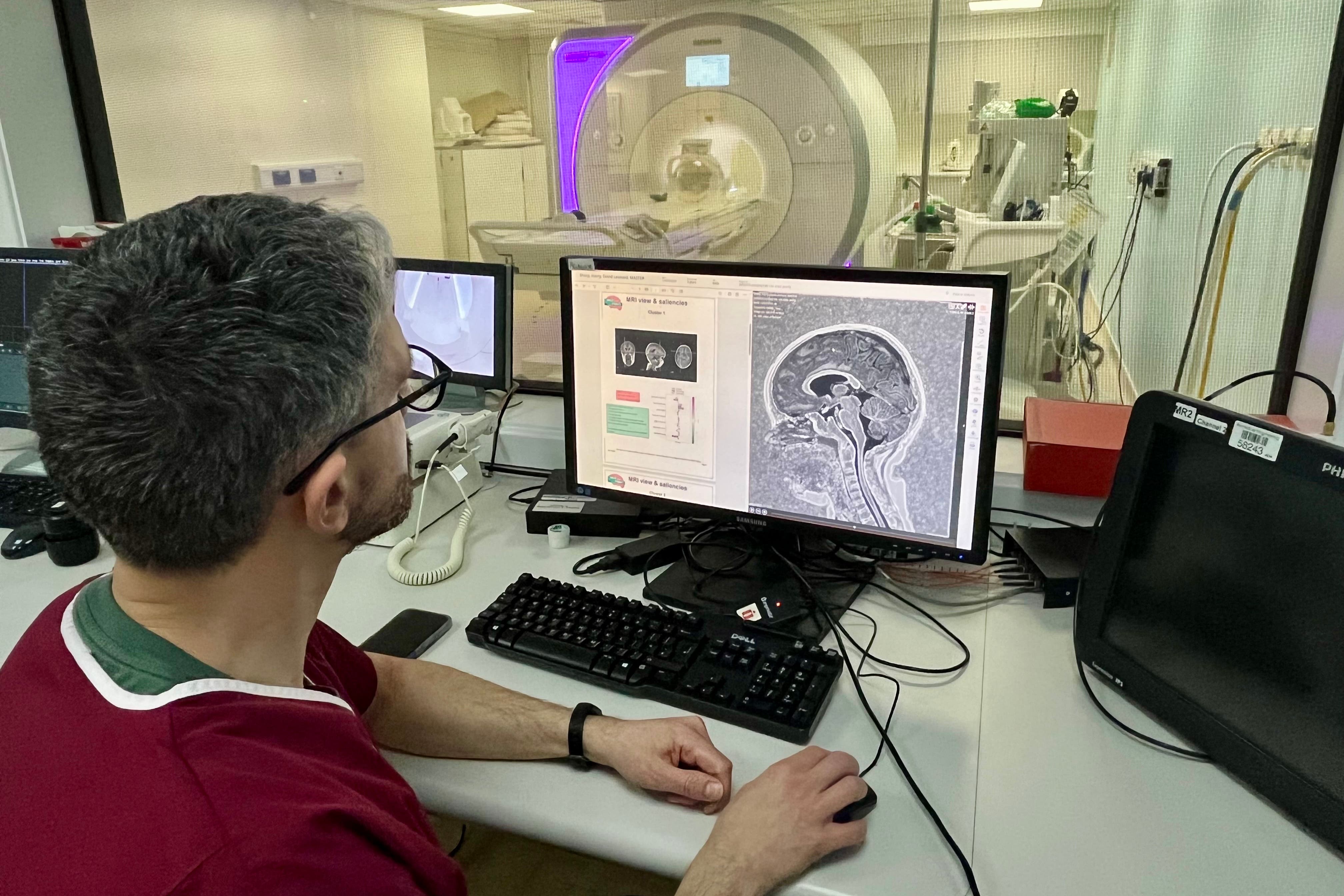 Dr Felice D’Arco, consultant radiologist at Great Ormond Street Hospital, reviewing the scan and AI report of a person with complex epilepsy (King’s College London/PA)