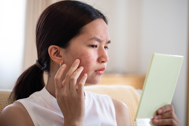 <p>Dr Stefanie Williams and Dr Aiza Jamil have shared their expert advice on tackling the common skin concern </p>