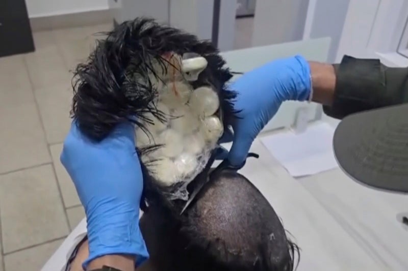 Colombian police catch a man smuggling packets of cocaine under toupee