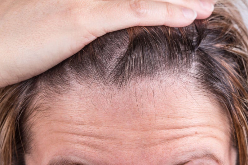 Why your hair is thinning and how to fix it